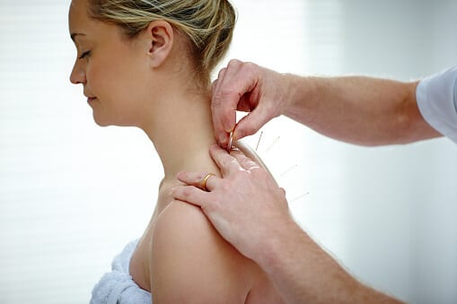 Acupuncture Therapy for woman detoxing