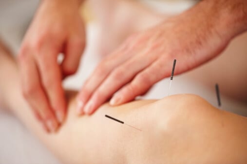 Mind and body benefits of acupuncture during recovery